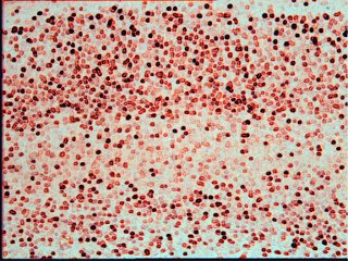 Fos staining in cortex